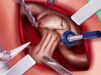 https://game.moais10.com/game/princess-hips-surgery